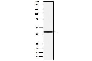 Western blot analysis of BGAT expression in 293T cell lysate.