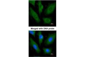 ICC/IF Image Immunofluorescence analysis of paraformaldehyde-fixed HeLa, using SCY1 like 3, antibody at 1:200 dilution. (SCYL3 antibody  (Center))