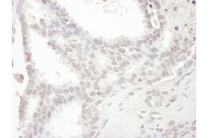 Immunohistochemistry (IHC) image for anti-NCK Interacting Protein with SH3 Domain (NCKIPSD) (AA 672-722) antibody (ABIN7454847) (NCKIPSD antibody  (AA 672-722))