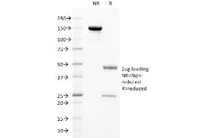 SDS-PAGE Analysis Purified HNF1A Mouse Monoclonal Antibody (HNF1A/2087). (HNF1A antibody  (AA 214-339))