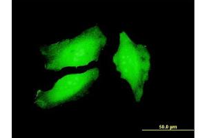 Immunofluorescence of monoclonal antibody to PADI4 on HeLa cell. (PAD4 antibody  (AA 2-110))