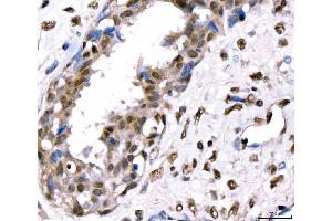 IHC analysis of CRTC3 using anti-CRTC3 antibody (ABIN7599779). (CRTC3 antibody  (AA 116-619))