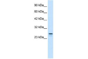 WB Suggested Anti-RNF2 Antibody Titration:  1. (RNF2 antibody  (Middle Region))