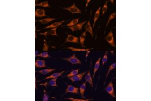 Immunofluorescence analysis of L929 cells using R antibody (ABIN7269856) at dilution of 1:100.