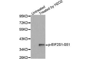 Western Blotting (WB) image for anti-Eukaryotic Translation Initiation Factor 2 Subunit 1 (EIF2S1) (pSer51) antibody (ABIN1870140) (EIF2S1 antibody  (pSer51))
