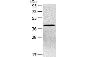 Western blot analysis of Hepg2 cell, using PTX3 Polyclonal Antibody at dilution of 1:400 (PTX3 antibody)