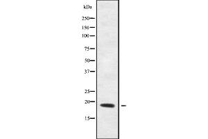 Western blot analysis of REG4 using HeLa whole cell lysates (REG4 antibody  (Internal Region))