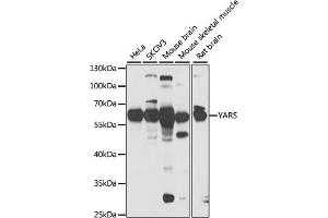 Western blot analysis of extracts of various cell lines, using YARS antibody (ABIN6128883, ABIN6150324, ABIN6150325 and ABIN6222537) at 1:1000 dilution. (YARS antibody  (AA 1-300))