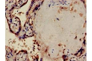 Immunohistochemistry of paraffin-embedded human placenta tissue using ABIN7169304 at dilution of 1:100 (PPP1CA antibody  (Catalytic Subunit))