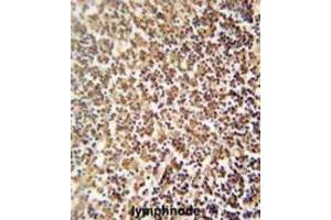 Immunohistochemistry (IHC) image for anti-Zinc Finger Protein 98 (ZNF98) antibody (ABIN2995694) (ZNF98 antibody)
