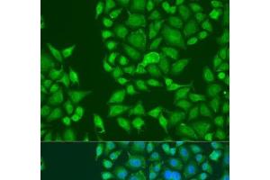 Immunofluorescence analysis of U2OS cells using STAU2 Polyclonal Antibody at dilution of 1:100. (Double-stranded RNA-binding protein Staufen homolog 2 (STAU2) antibody)