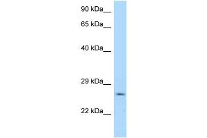 WB Suggested Anti-Ywhag Antibody Titration: 1. (14-3-3 gamma antibody  (N-Term))