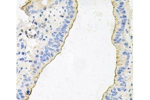 Immunohistochemistry of paraffin-embedded Mouse lung using HPR Polyclonal Antibody at dilution of 1:100 (40x lens). (HPR antibody)