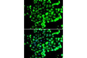 Immunofluorescence analysis of U20S cell using FASTK antibody. (FASTK antibody)