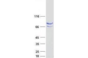 Western Blotting (WB) image for Zinc Finger, BED-Type Containing 1 (ZBED1) protein (Myc-DYKDDDDK Tag) (ABIN2735763)
