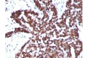Immunohistochemistry (Formalin-fixed Paraffin-embedded Sections) (IHC (fp)) image for anti-Cyclin B1 (CCNB1) antibody (ABIN3025089)