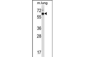 Mouse Mknk2 Antibody (N-term) (ABIN657843 and ABIN2846804) western blot analysis in mouse lung tissue lysates (35 μg/lane). (MKNK2 antibody  (N-Term))