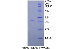SDS-PAGE analysis of Rat vWA1 Protein. (VWA1 Protein)