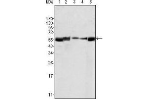 Western blot analysis using LYN mouse mAb agains HL60 (1), L540 (2), SLLP-M2 (3), SEM (4) and Ramos (5) cell lysate. (LYN antibody)