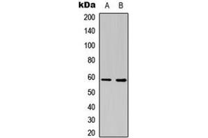 Western blot analysis of Estrogen Receptor 2 expression in COLO205 (A), NIH3T3 (B) whole cell lysates. (ESR2 antibody  (Center))