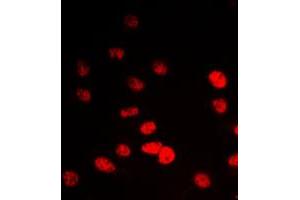 Immunofluorescent analysis of IP6K2 staining in A549 cells. (IP6K2 antibody  (Center))