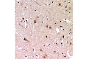 Immunohistochemical analysis of ZP2 staining in human brain formalin fixed paraffin embedded tissue section. (ZP2 antibody)