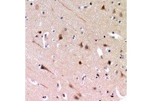 Immunohistochemical analysis of ZP2 staining in human brain formalin fixed paraffin embedded tissue section. (ZP2 antibody)