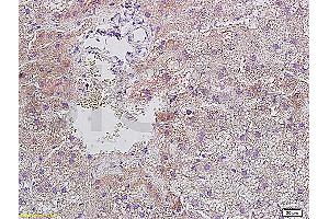 Formalin-fixed and paraffin embedded rat liver tissue with Anti-Resistin Polyclonal Antibody, Unconjugated (ABIN728278) at 1:400, followed by conjugation to the secondary antibody and DAB staining (Resistin antibody  (AA 21-114))