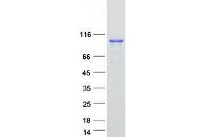 Dynamin 2 (DNM2) (Transcript Variant 1) protein (Myc-DYKDDDDK Tag)