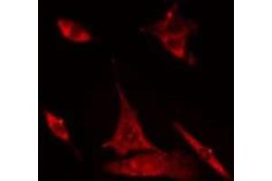 ABIN6275020 staining Hela cells by IF/ICC. (CLASP1 antibody  (Internal Region))