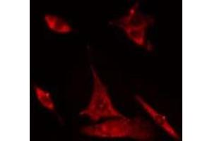 ABIN6275020 staining Hela cells by IF/ICC. (CLASP1 antibody  (Internal Region))