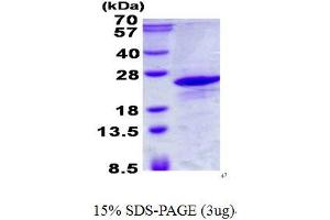 Image no. 1 for Immature Colon Carcinoma Transcript 1 (ICT1) protein (His tag) (ABIN1098472)