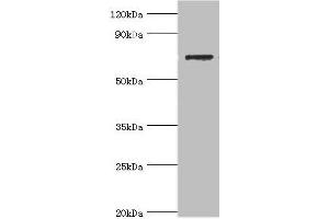 Western blot All lanes: SLC25A13 antibody at 3 μg/mL + HepG2 whole cell lysate Secondary Goat polyclonal to rabbit IgG at 1/10000 dilution Predicted band size: 74 kDa Observed band size: 74 kDa (slc25a13 antibody  (AA 1-300))
