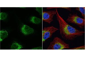 ICC/IF Image Fibrinogen gamma antibody detects Fibrinogen gamma protein at cytoplasm by immunofluorescent analysis. (FGG antibody)