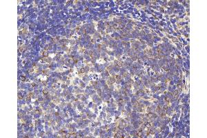 Immunohistochemistry analysis of paraffin-embedded rat lymph using CD284 Polyclonal Antibody at dilution of 1:1000. (TLR4 antibody)