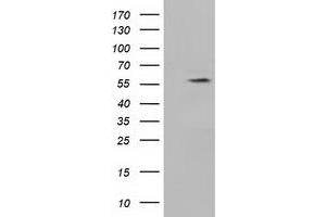 HEK293T cells were transfected with the pCMV6-ENTRY control (Left lane) or pCMV6-ENTRY KLHL2 (Right lane) cDNA for 48 hrs and lysed. (KLHL2 antibody  (AA 1-100, AA 494-593))