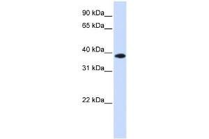WB Suggested Anti-GPD1L Antibody Titration: 0. (GPD1L antibody  (Middle Region))