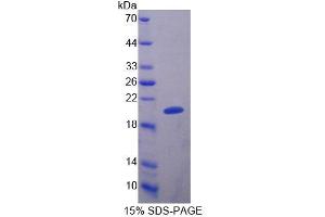 SDS-PAGE analysis of Human MRPL1 Protein. (MRPL1 Protein)