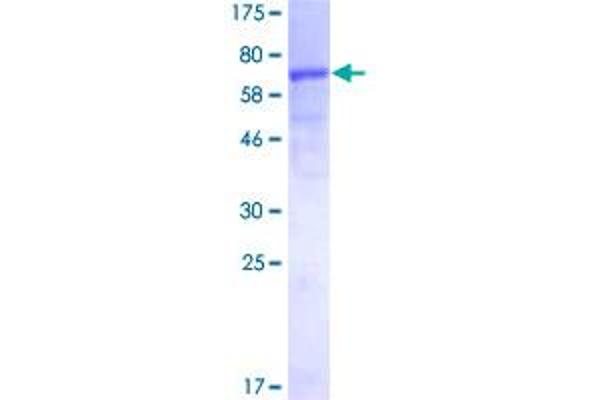 ERCC8 Protein (AA 1-396) (GST tag)