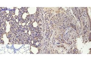 Immunohistochemistry of paraffin-embedded Rat lung tissue using BMP2 Polyclonal Antibody at dilution of 1:200. (BMP2 antibody)