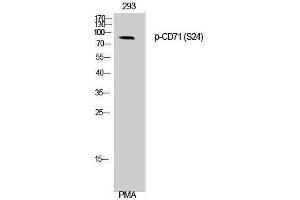 Western Blotting (WB) image for anti-Transferrin Receptor (p90, CD71) (TFRC) (pSer24) antibody (ABIN3182612) (Transferrin Receptor antibody  (pSer24))