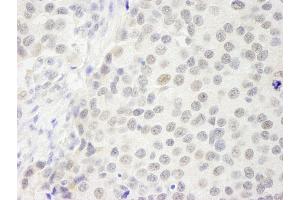 Immunohistochemistry (IHC) image for anti-GATA Zinc Finger Domain Containing 2B (GATAD2B) (AA 50-100) antibody (ABIN7448709) (GATAD2B antibody  (AA 50-100))