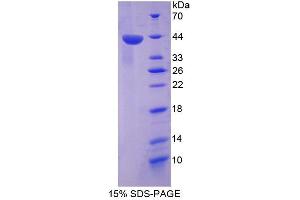 Image no. 1 for TP53 Target 5 (TP53TG5) (AA 190-262) protein (His tag) (ABIN6239146) (TP53TG5 Protein (AA 190-262) (His tag))