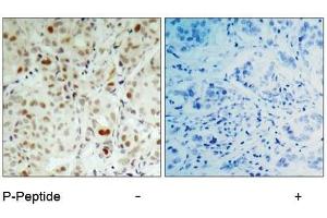 Image no. 2 for anti-Retinoblastoma 1 (RB1) (pSer807) antibody (ABIN196841) (Retinoblastoma 1 antibody  (pSer807))