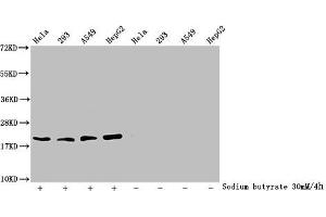 Western Blot Detected samples: Hela whole cell lysate, 293 whole cell lysate, A549 whole cell lysate, HepG2 whole cell lysate, Untreated (-) or treated (+) with 30 mM sodium butyrate for 4h All lanes: HIST1H1C antibody at 2. (HIST1H1C antibody  (acLys84))