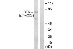 Western blot analysis of extracts from Hela cells treated with serum using BTK (phospho-Tyr223) Antibody. (BTK antibody  (pTyr223))
