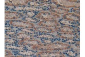 DAB staining on IHC-P; Samples: Human Kidney Tissue (MUC1 antibody  (AA 1098-1255))