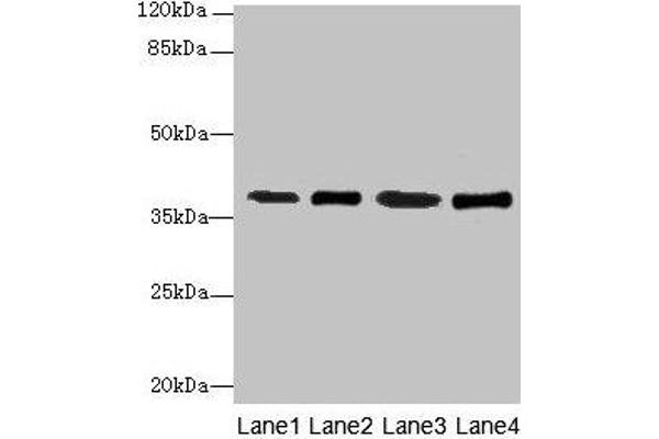 Sideroflexin 4 anticorps  (AA 2-110)