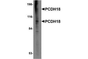 Western Blotting (WB) image for anti-Protocadherin 18 (PCDH18) (N-Term) antibody (ABIN1031506) (PCDH18 antibody  (N-Term))