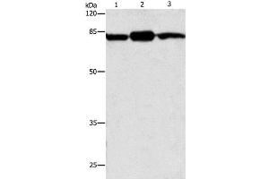 Western Blot analysis of Mouse brain and skin tissue, 293T cell using CAPN2 Polyclonal Antibody at dilution of 1:200